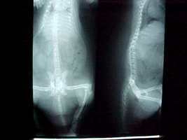 X-ray showing improved bone density