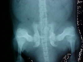Pevic X-ray showing good bone density