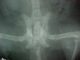 Pelvic X-ray of broken femur