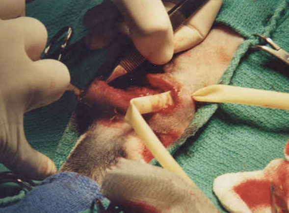 Inserting a drain tube in the affected area