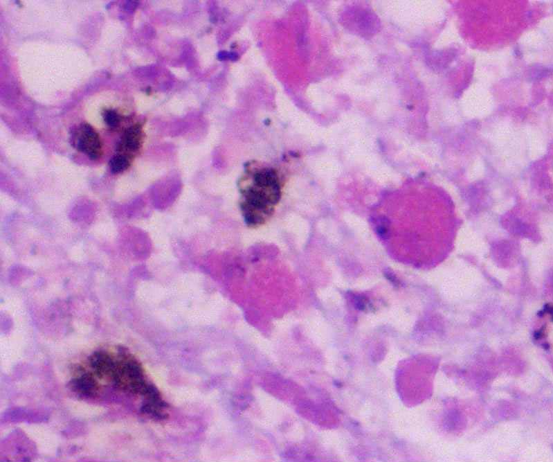 Liver tissue slide