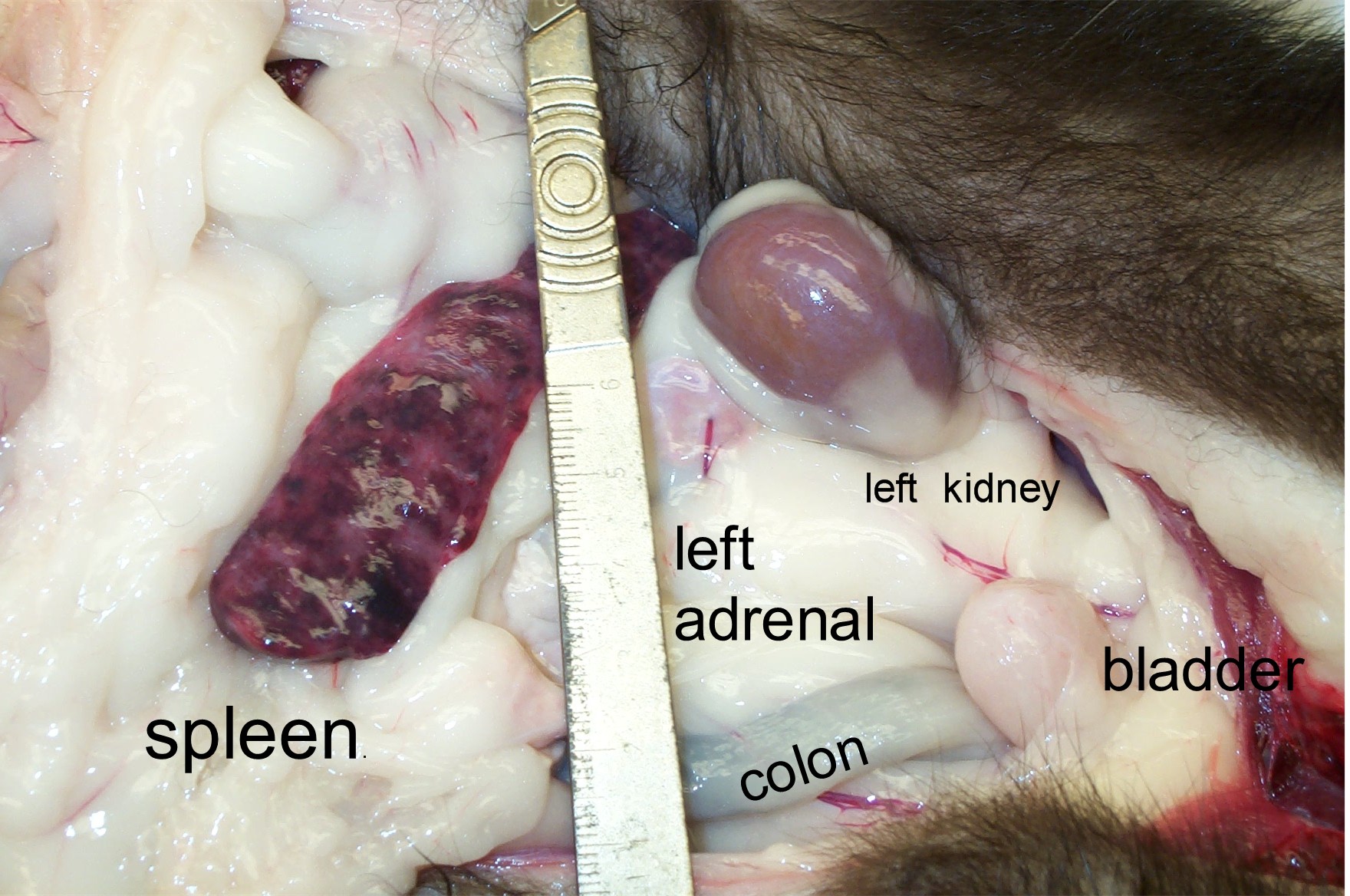 Spleen, left adrenal, left kidney, and bladder