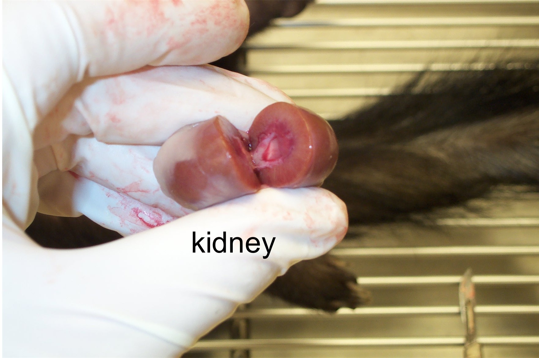 Disected kidney
