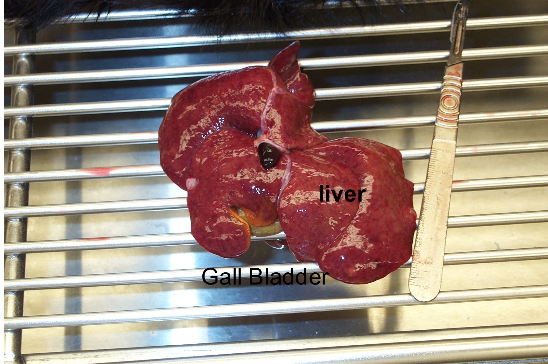 Liver and gall bladder